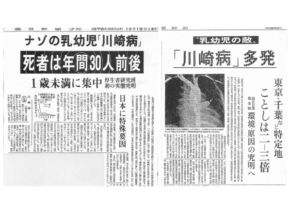 川崎病について千葉市立海浜病院