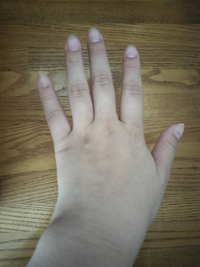 指の関節が太くて硬いのが悩み。しなやかに保つ方法はある？ 手が老けて見える原因と改善法＜3＞