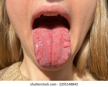 舌で美容体質を知る方法2024 年のリアルなLemon8ユーザー体験