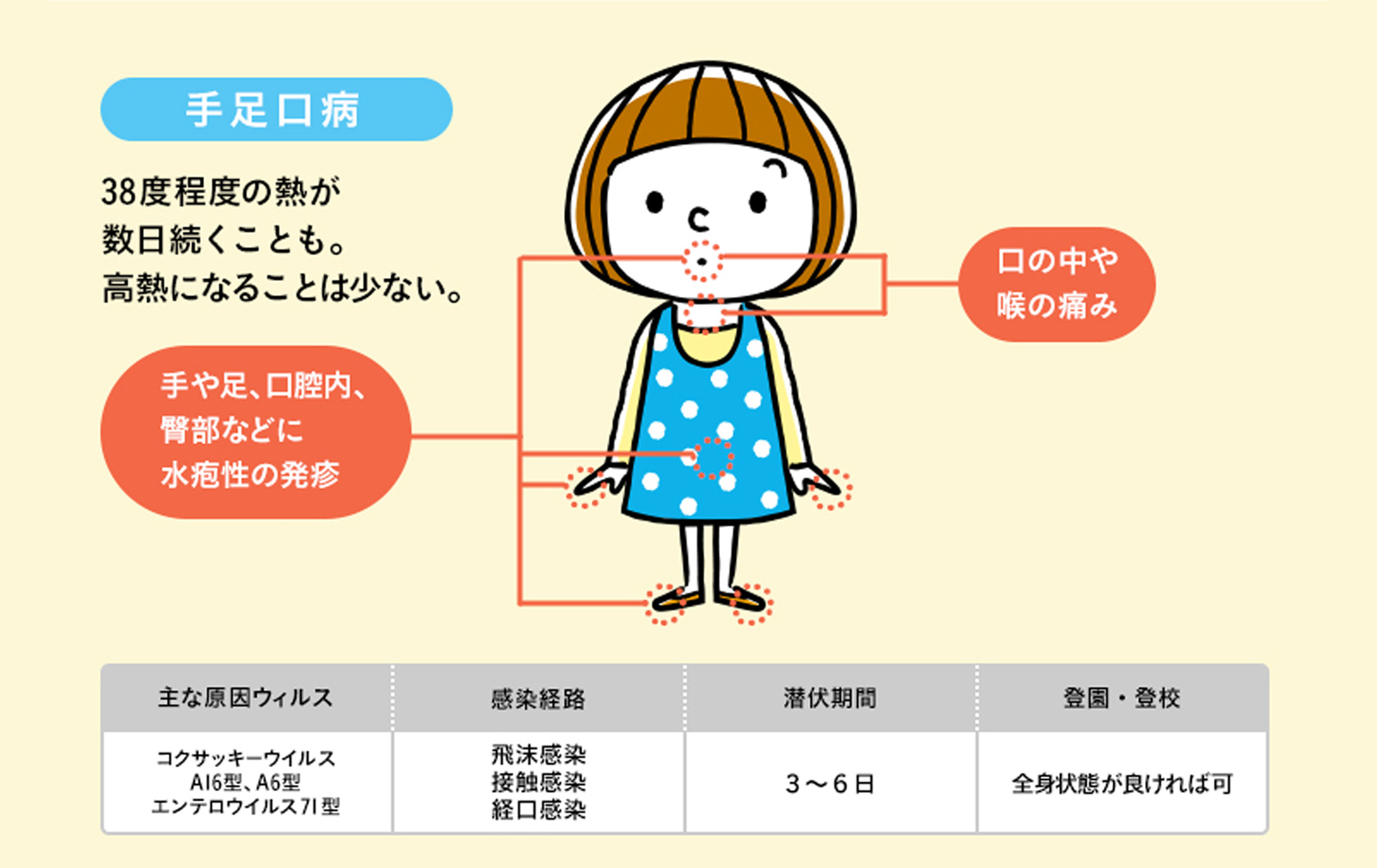 子どもの夏風邪 「ヘルパンギーナ」「咽頭結膜熱 プール熱 」 原因・症状・対処法を小児科医が解説 - コクリコ講談社