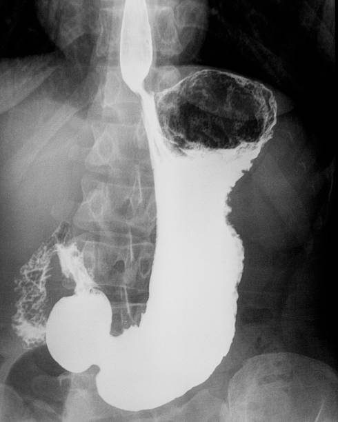 胃バリウム検査とは？胃カメラ検査と違い鹿児島中央駅西口消化器内科・胃大腸内視鏡クリニック