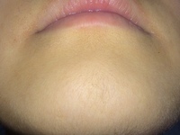 ヒゲ脱毛女性TikTok