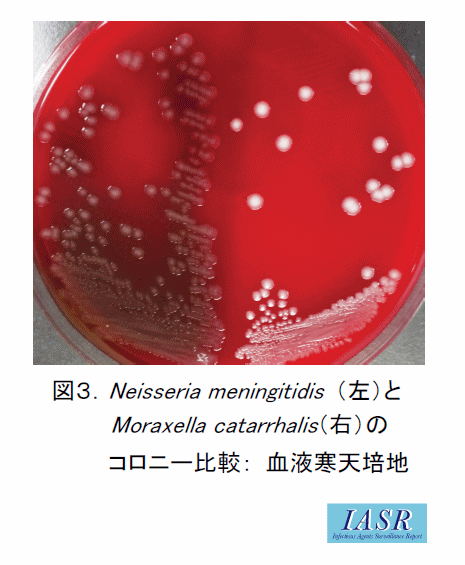菌種別 <span class=