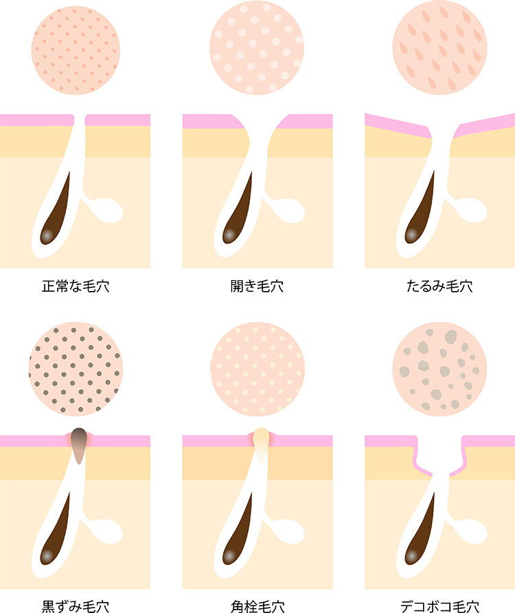 花王の顔なぜ角栓は落ちないのか？スキンケア研究員が暴く驚きの実態