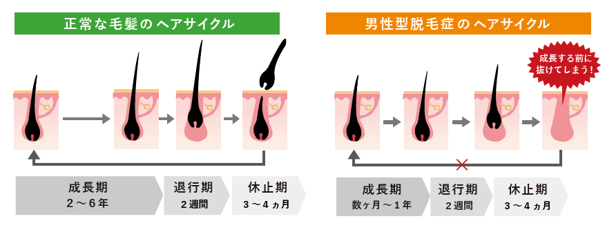 髪が生えて伸びて抜けるまでのヘアサイクルの解説 - 髪の悩みが解決できる美容室WHAT COMES AROUND