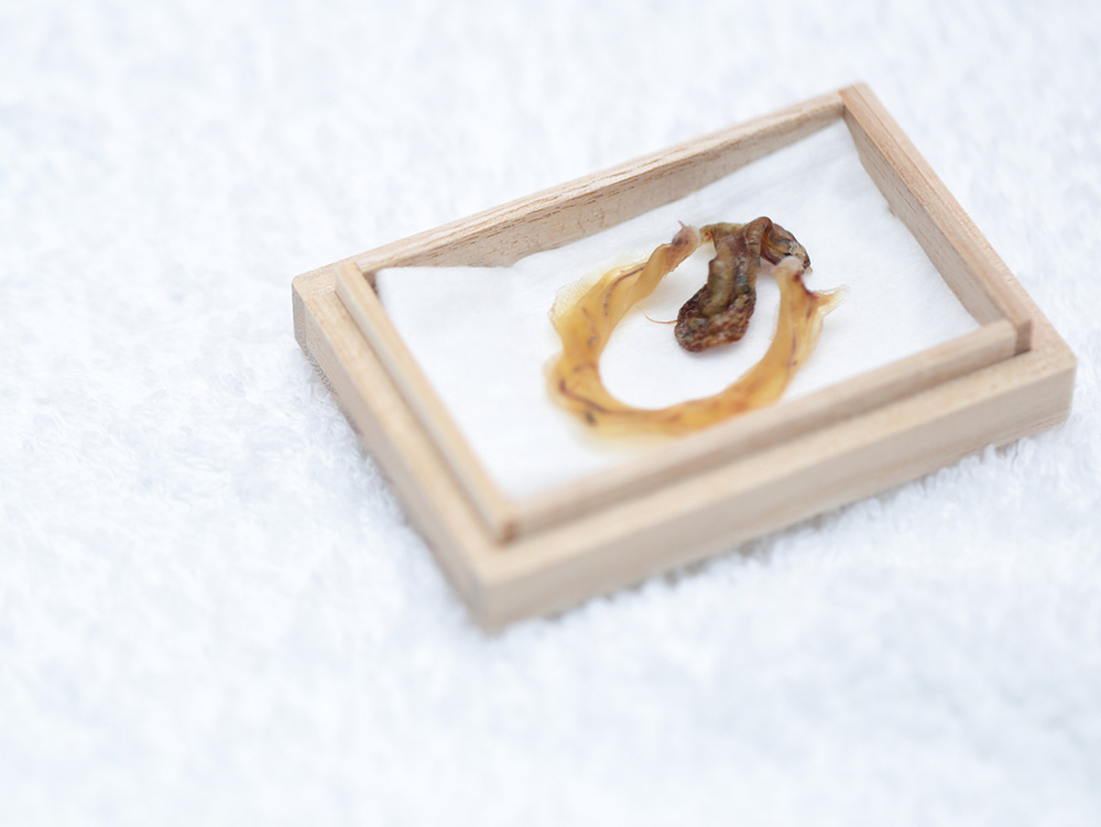 お産の話−１２ 「へその緒の正体 その２」」有限会社シェパード中央家畜診療所