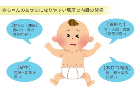 汗も野田市 小児科 千葉県 こどもの花粉症 こどもの漢方 喘息 アトピー性皮膚炎 アレルギー 結節性痒疹 たんぽぽこどもクリニック