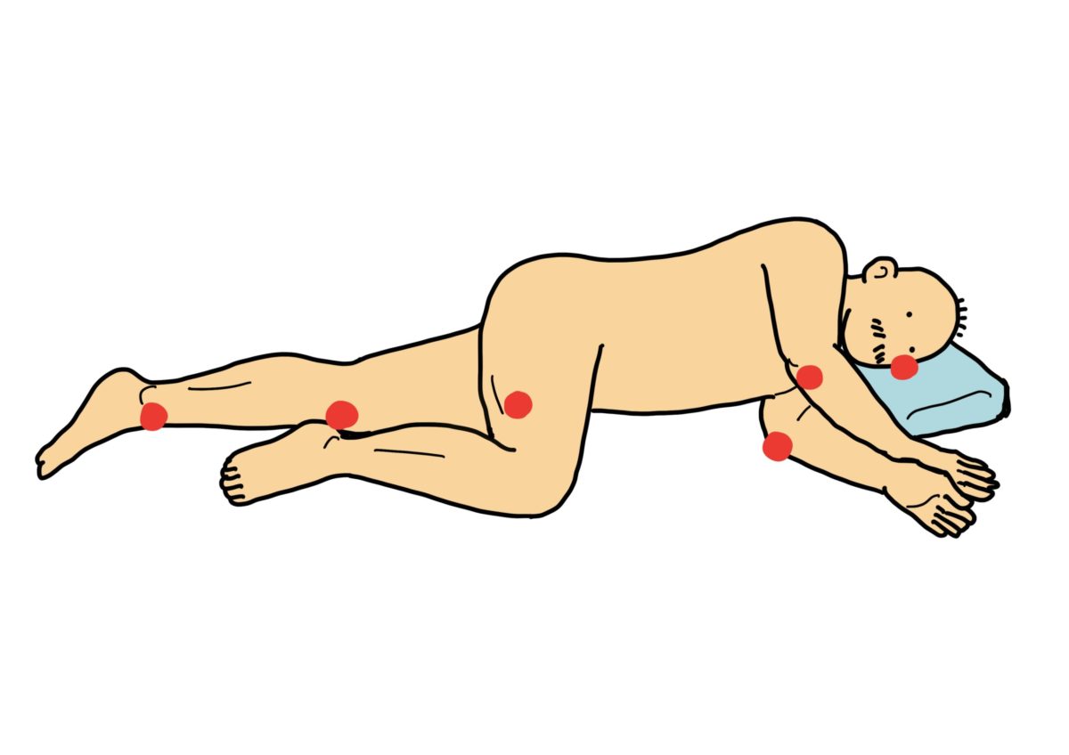 褥瘡とは？定義・原因・看護ケアについて解説レバウェル看護 お役立ち情報