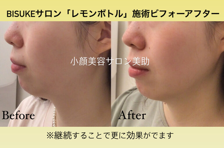 犬さんのヒキガエル中毒 - 静岡市清水区の動物病院 みなとまちアニマルクリニック 清水区動物医療センター