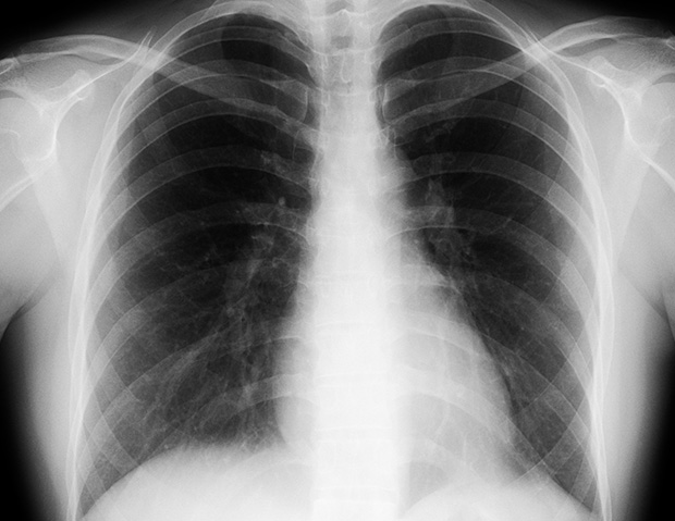 レントゲン検査 下半身 立体 の画像素材医療・福祉の写真素材ならイメージナビ