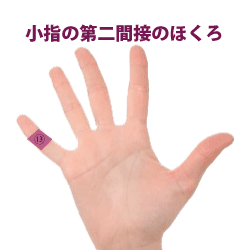 右手薬指はモテほくろ！ 指のほくろで運勢をみてみようエピテーゼ専門サロン『エピテみやび』完全オーダーメイド