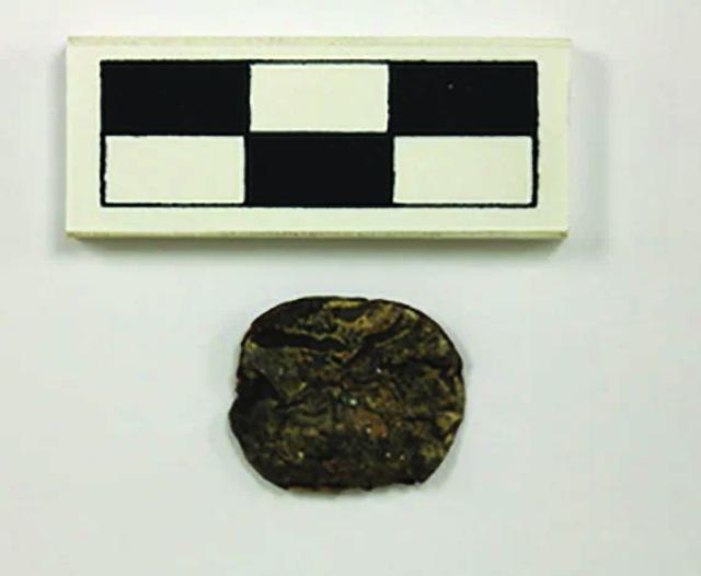 人気のRF 高周波 治療、インモードのフォーマのビフォーアフター 照射前・直後写真- えびす形成・整形クリニックブログ