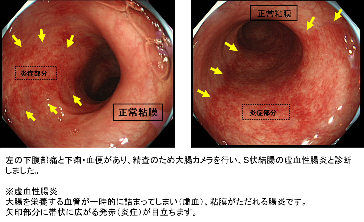 朝お腹が痛い、吐き気、だるさ、起きれない起立性調節障害、吐き気のツボツボネット 鍼灸の症例が検索できるツボ辞典