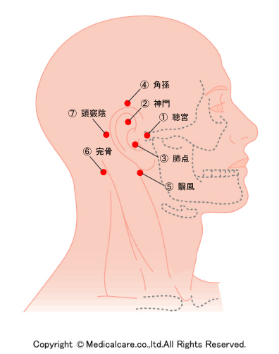 耳鳴りのツボ芝公園・浜松町・赤羽橋・三田 芝公園整骨治療院
