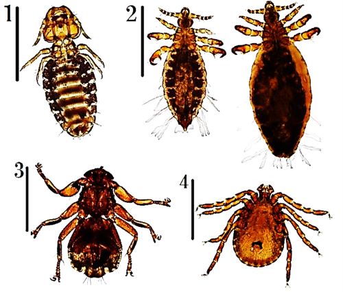 腸内を「寄生虫だらけ」にする人糞集めが今年も北朝鮮国民を苦しめる 高英起- エキスパート - Yahoo!ニュース