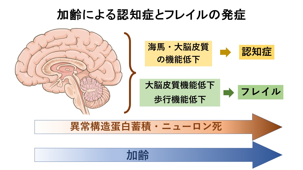 VioraWhite 高齢者向け認知症アクティビティ、高齢者向けドミノアクティビティキット、高齢者向け