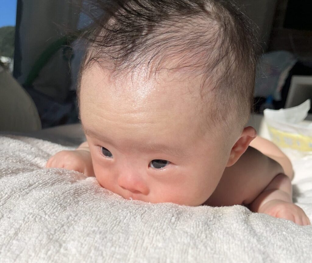 コラム世界ダウン症の日大橋ちよ