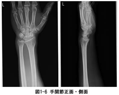 子どもの手のレントゲン 01809017063 の写真・イラスト素材アマナイメージズ