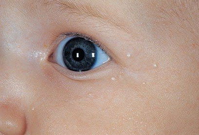 小児科医監修 顔色が悪い赤ちゃん、意外な原因たまひよ