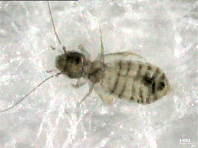 害虫被害 木造家屋を食い荒らす厄介者。「シロアリ」の正体に迫る！害獣駆除ガイド