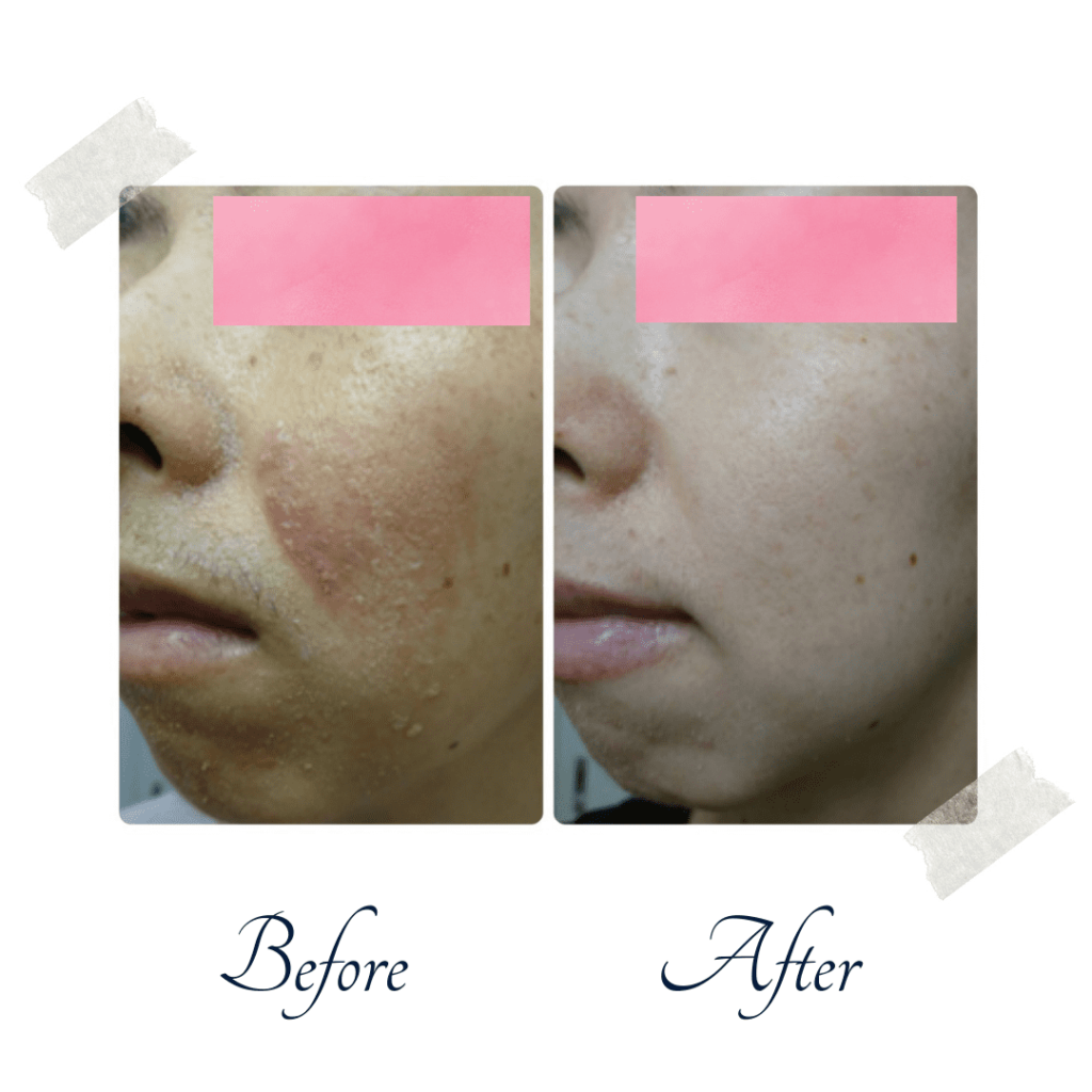 ４０代肌断食レポート1 肌断食30日経過│Limo-Art