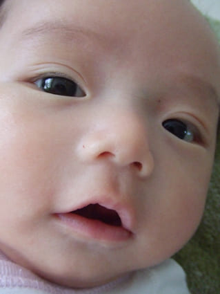 三重まぶた 生まれつきTikTok