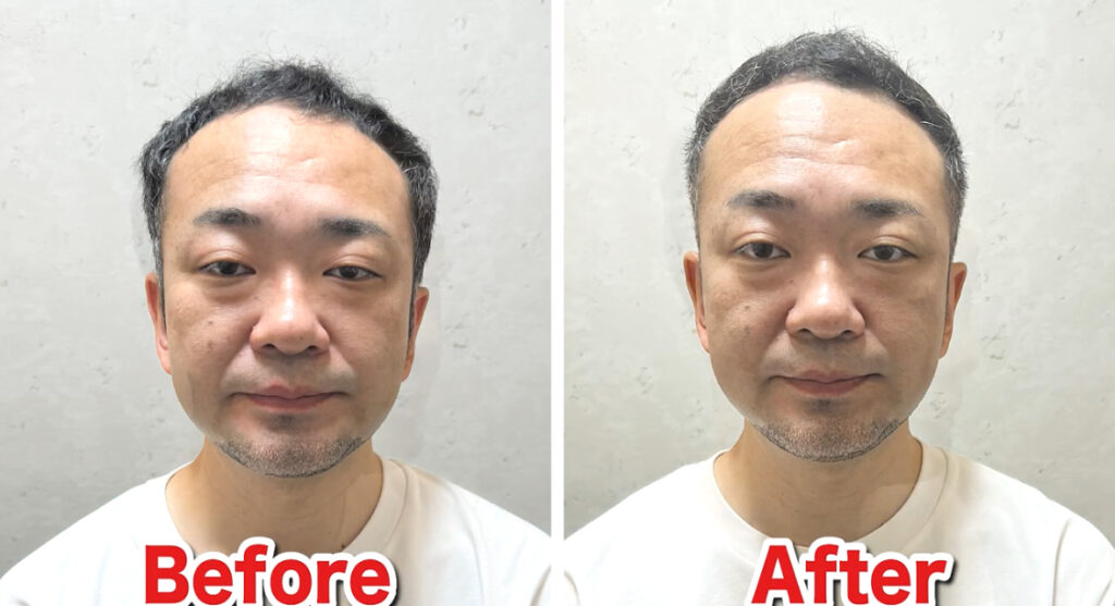 40代の薄毛対策カット術髪型で10歳若返る秘訣とは？ - カットサロン Hand's - 静岡市駿河区のメンズおすすめ床屋・理容室