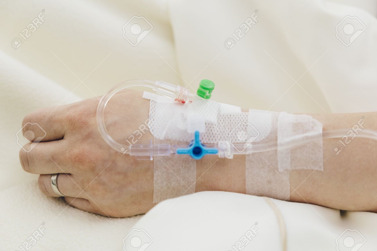 点滴・輸液をする女性の腕「医療用具」の写真素材207701926 毎月1点無料 フリー のストックフォト イメージマート