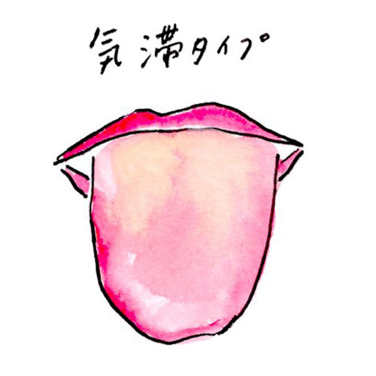 舌のサイン 院長ブログ八尾市のオカモト鍼灸整骨院