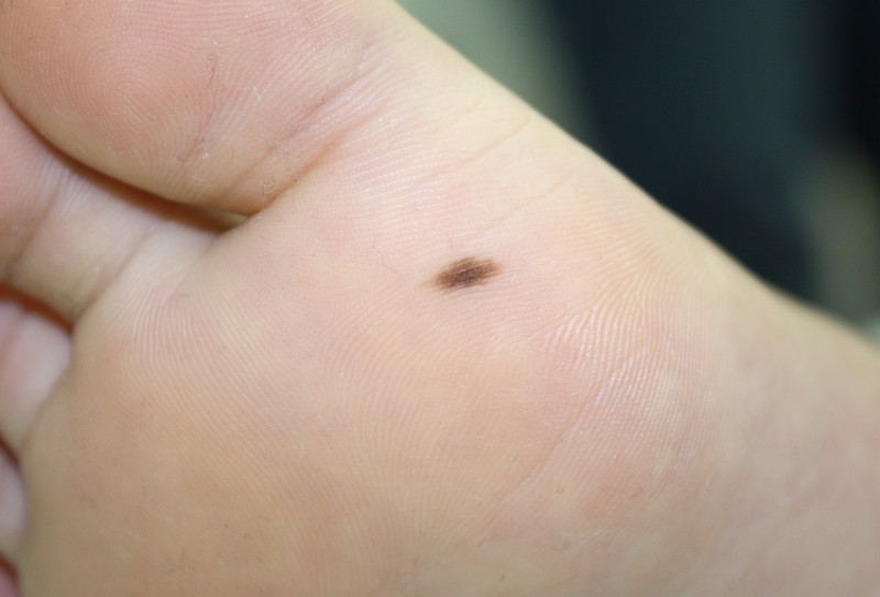 がん・疾患情報サービス新潟県立がんセンター新潟病院