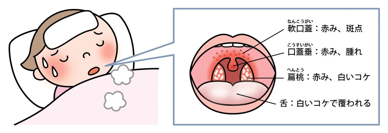 見てわかるのどの病気 耳鼻咽喉科内藤クリニック