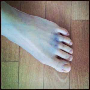 アットノン アオキュア 5g 小林製薬 第2類医薬品- アスクル