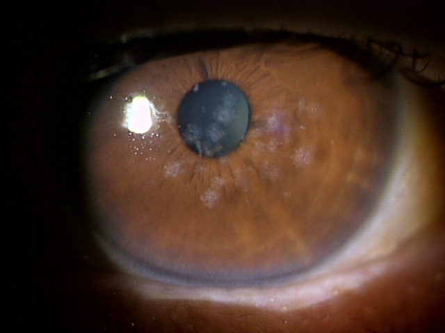 油断しないで！猫の目やにには要注意 その原因と対処法を紹介 獣医師監修「犬や猫ともっと幸せに」をコンセプトにしたWEBメディア「sippo」