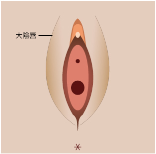 大陰唇縮小 大陰唇のたるみとりライフビューティークリニック大宮
