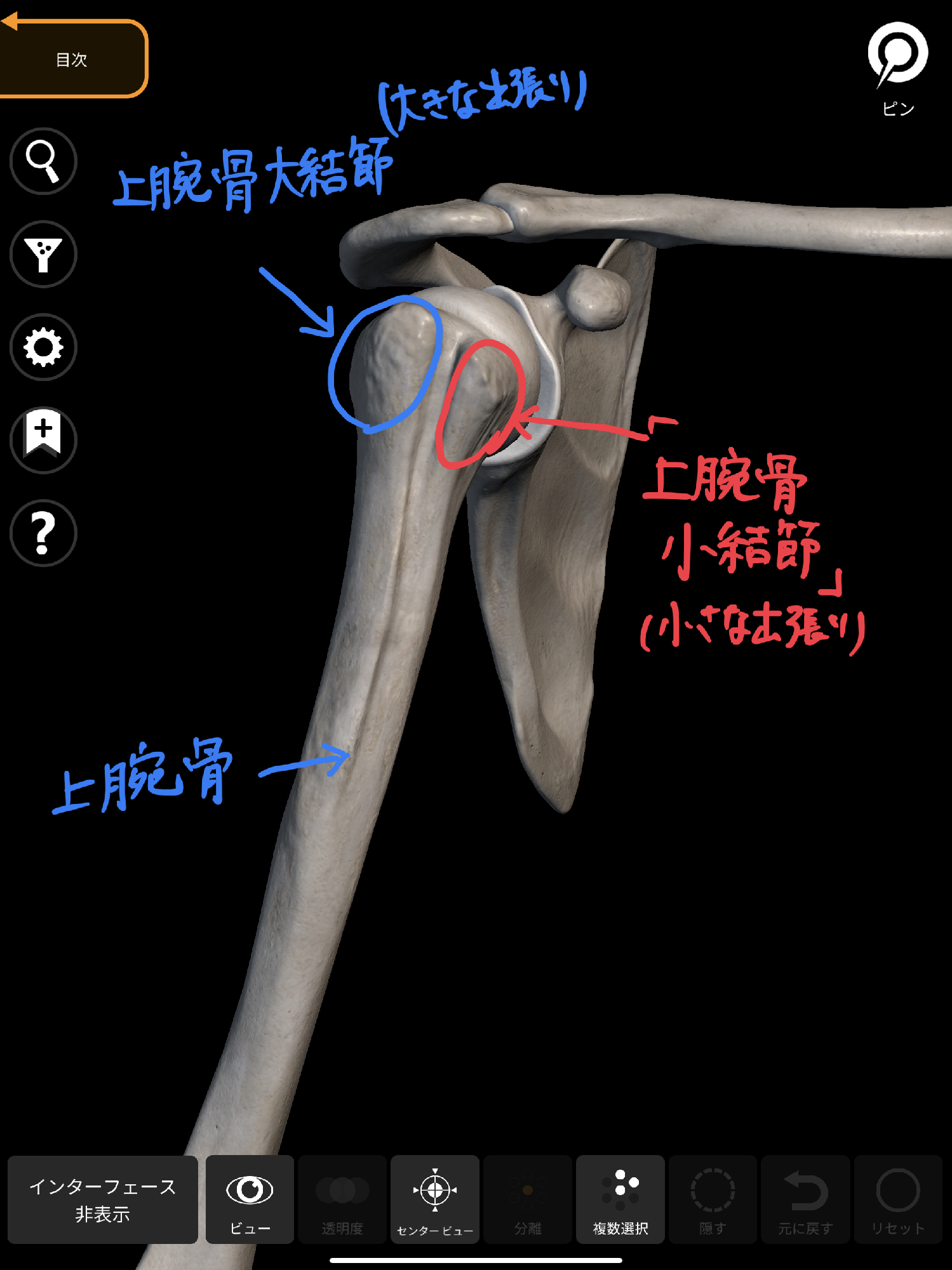上腕二頭筋腱断裂 じょうわんにとうきんけんだんれつ について