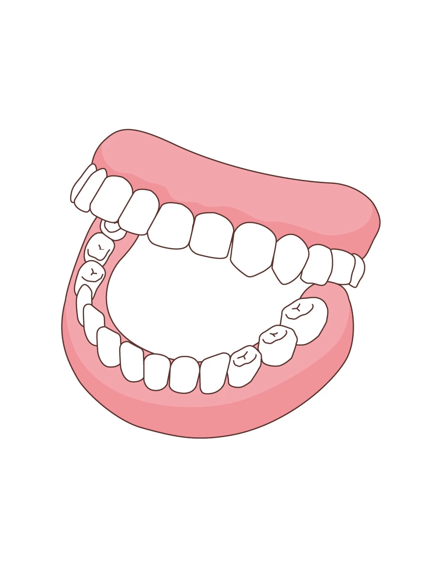 入れ歯」の13万点のロイヤリティフリー画像、写真素材、絵Shutterstock