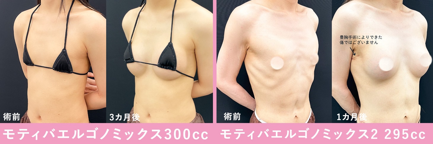 男性がバストアップクリームを使うとどんな効果がある？ – K Village Meon 韓国スキンケア専門通販サイト