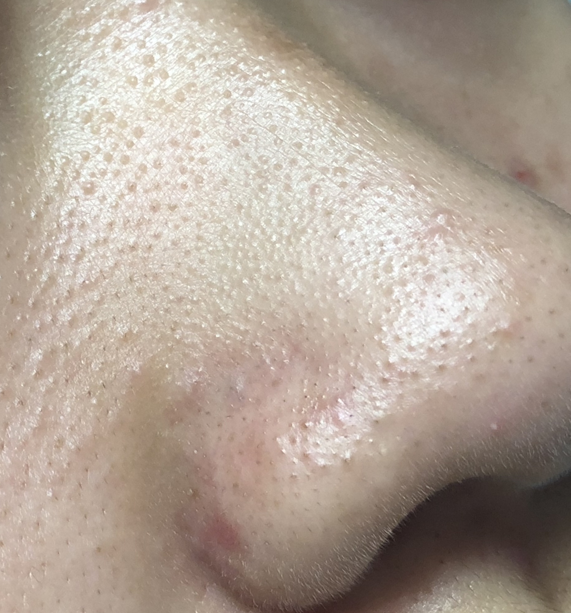 新生児の鼻にある白い点々 - 沖縄本島のダイビングで撮影した水中写真サイト OKINAWANFISH