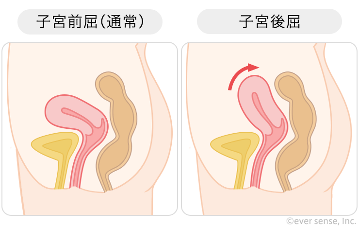 触って！ 赤ちゃんの位置はどんなかな？子宮の硬さは？赤ちゃんと触れ合いできていますか？How to check the position of thebaby by palpation - YouTube