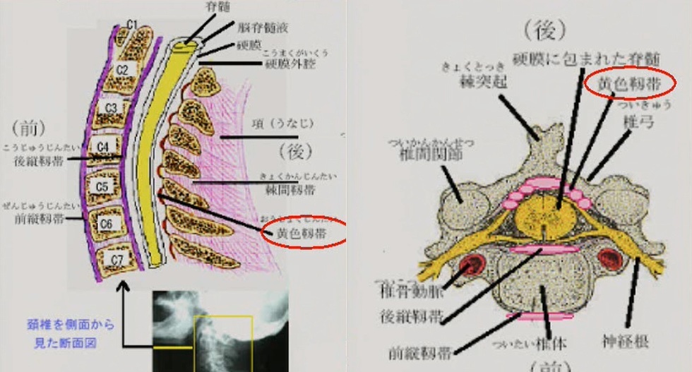 脊髄 - 09. 脳、脊髄、末梢神経の病気 - MSDマニュアル家庭版