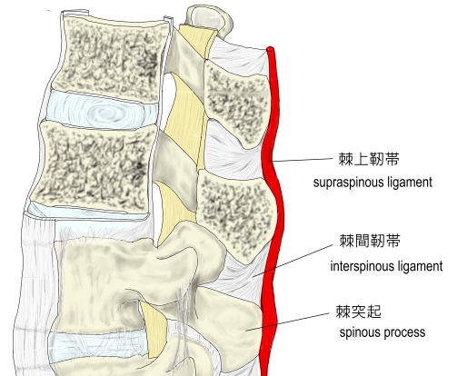 棘上靭帯炎 - 倉敷市ジール鍼灸整骨院 整体院