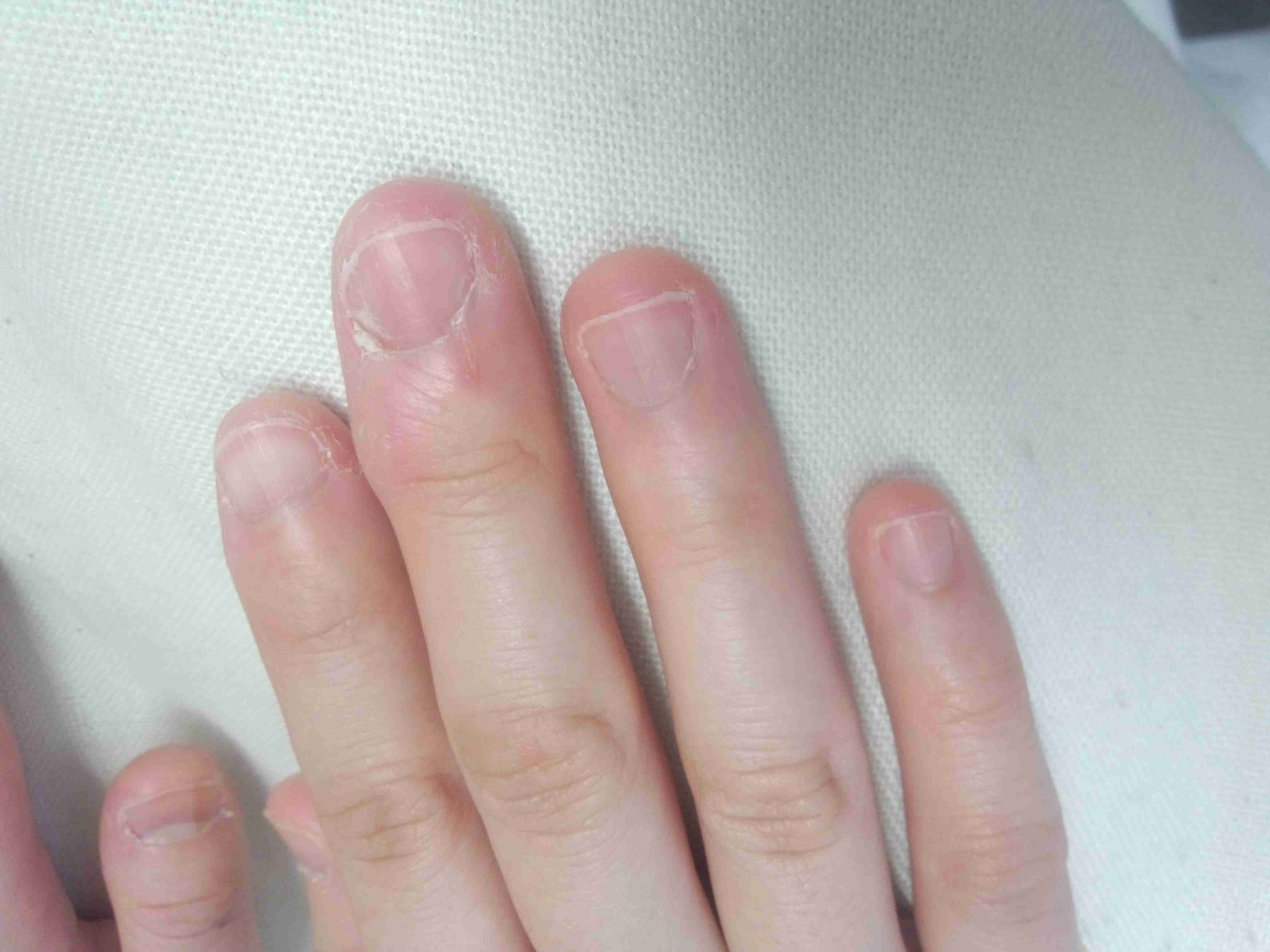 ショートネイルの整え方とデザインガイド