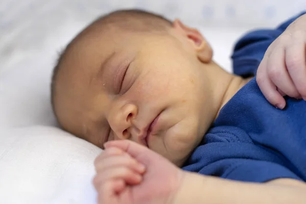 新生児は黄疸を伴うどのような病気にかかるリスクがありますか