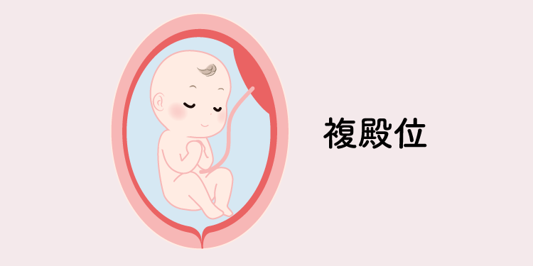 臨月を快適に過ごすためのマタニティ生活ガイド 医師監修