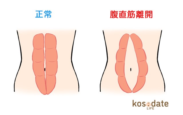 産後のお腹を綺麗にする治療美容皮膚科 麻布皮フ科クリニック