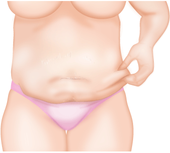 産後のお腹のたるみ・皮の戻し方！筋トレ・コルセットで引き締め方を解説産前産後ケアホテル ぶどうの木 コラム