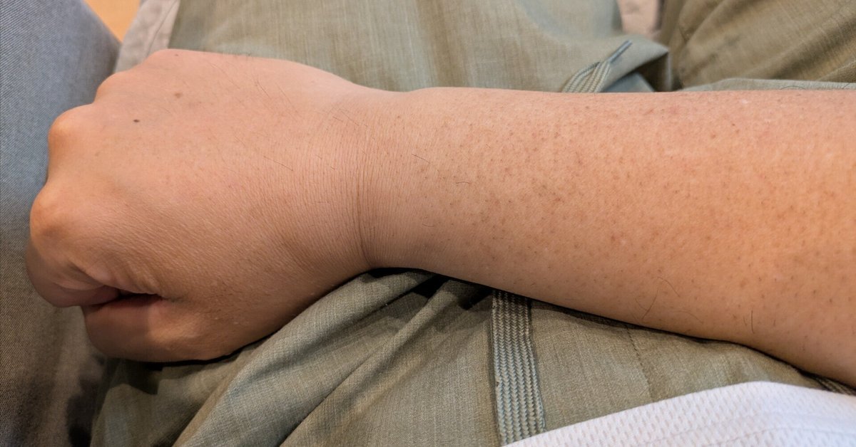 パナソニックのボディートリマーで腕毛処理の方法を紹介