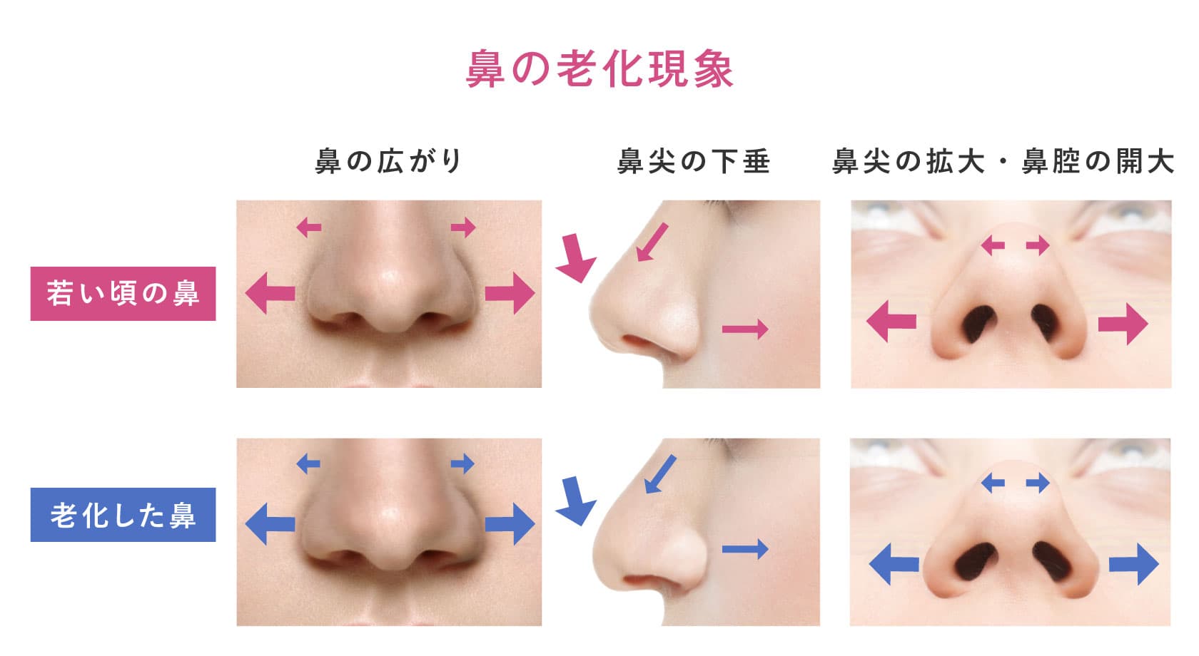 たるみの原因に！「頭蓋骨の老化」の防ぎかた美ST ONLINE