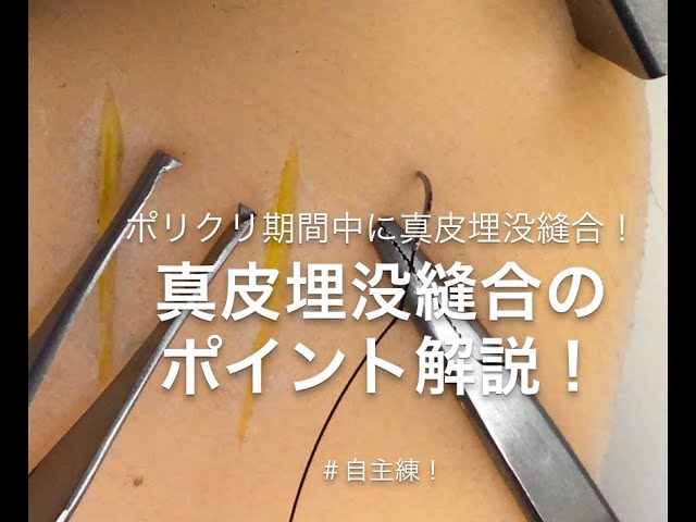 形成外科の縫合：傷跡修正ヒルズ美容クリニックは神奈川・湘南・藤沢の美容外科・美容皮膚科・形成外科