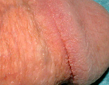 歯ブラシの正しい管理法医療法人 親和会 ヒサドメ歯科 鹿児島県 霧島の歯医者インプラント・予防歯科・ホワイトニング・一般歯科・小児歯科・歯科口腔外科医療法人 親和会 ヒサドメ歯科 鹿児島県 霧島の歯医者インプラント・予防歯科・ホワイトニング・一般歯科